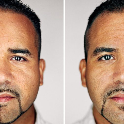 As infants, Ramon (left) and Eurides looked so much alike that their mother gave them name bracelets so she wouldn't get confused and feed the same child twice. Today at age 34, the twins are next-door neighbors in Florida, living in identical custom-built houses. A topic of family debate: Who has the fuller face? Ramon says it's Eurides. Eurides (and the mother) say it's Ramon.