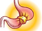 A stomach in a knot. A stomach in a knot.