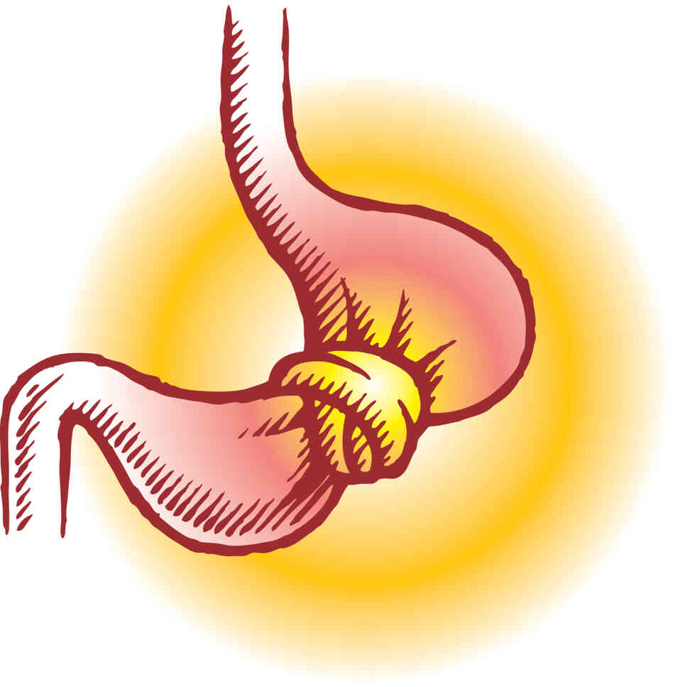 A stomach in a knot. A stomach in a knot.