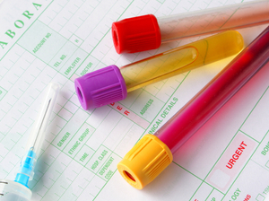 Interruptions in insurance coverage can be enough to deter people from getting preventive care. Interruptions in insurance coverage can be enough to deter people from getting preventive care.