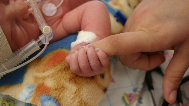 A little sugar can relieve preemies' pain in intensive care. A little sugar can relieve preemies' pain in intensive care.