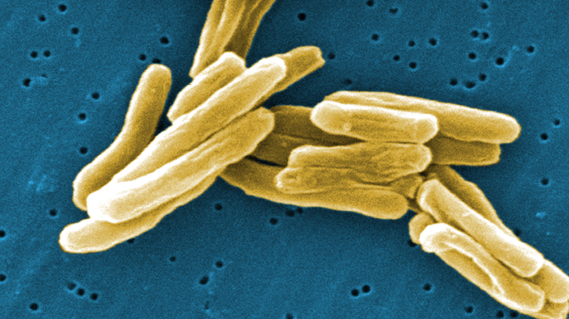An image of Mycobacterium tuberculosis bacteria captured with an electron microscope. 