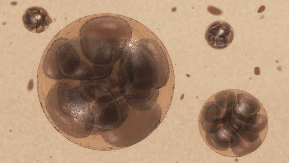 Less may be more when it comes to the number of embryos for in vitro fertilization. Less may be more when it comes to the number of embryos for in vitro fertilization.