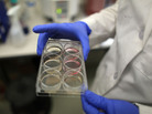 A scientist holds a tray of stem cells in a lab, in this file photo from 2010. A scientist holds a tray of stem cells in a lab, in this file photo from 2010.