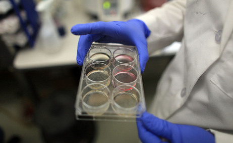 A scientist holds a tray of stem cells in a lab, in this file photo from 2010. A scientist holds a tray of stem cells in a lab, in this file photo from 2010.