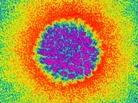 Human papilloma virus as seen through a colored transmission electron micrograph. Human papilloma virus as seen through a colored transmission electron micrograph.