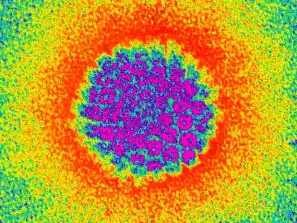 Human papilloma virus as seen through a colored transmission electron micrograph. Human papilloma virus as seen through a colored transmission electron micrograph.