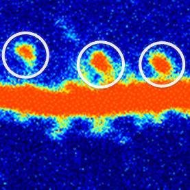 A rat neuron after treatment with ketamine.