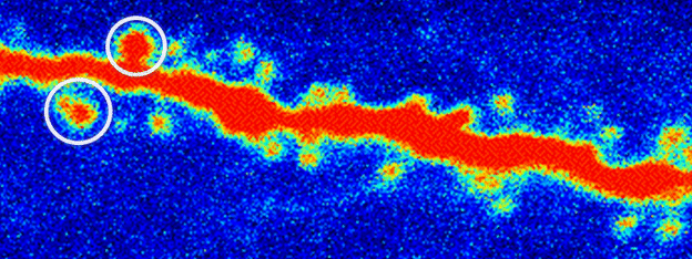 A rat neuron without ketamine treatment.