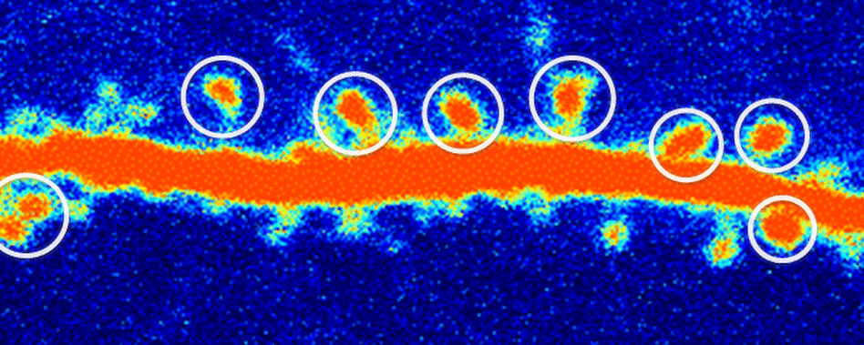 A rat neuron after treatment with ketamine.
