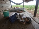 Chhay Meth, 9, suffering through an attack of malaria at the family's home in O'treng village on the outskirts of Pailin, Cambodia, in 2009. A drug-resistant form of malaria in the region medical led officials to declare a health emergency. Chhay Meth, 9, suffering through an attack of malaria at the family's home in O'treng village on the outskirts of Pailin, Cambodia, in 2009. A drug-resistant form of malaria in the region medical led officials to declare a health emergency.