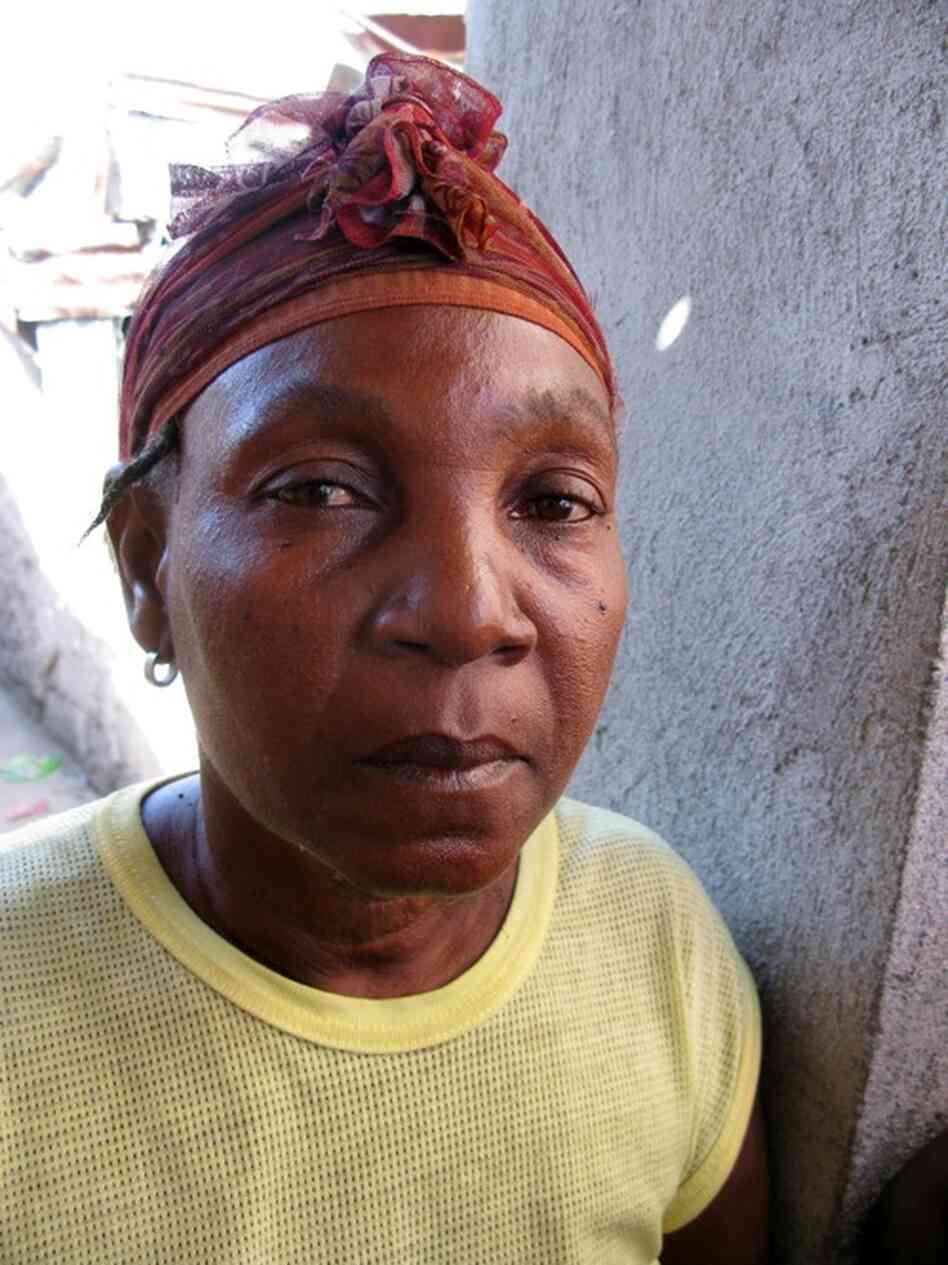 Antonina Tanis, 56, contracted cholera in November 2011. "I was vomiting. I had diarrhea," she recalls. "I couldn't stand up. I fell like three or four times trying to get to my feet." She says there's no way she could have gotten herself to medical care, and she would have died if her neighbors hadn't carried her to a clinic.