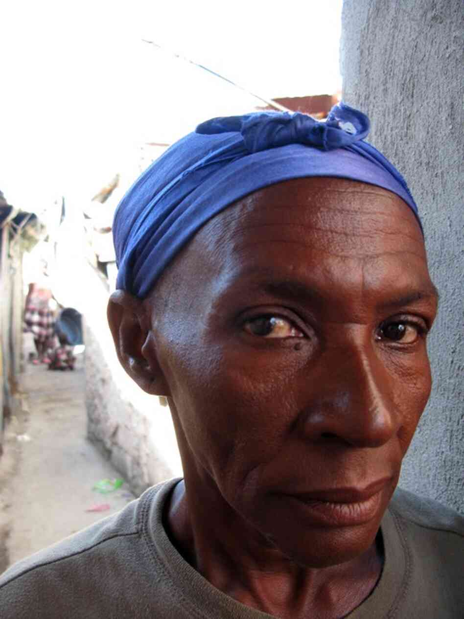 Fortille Charles, 50, says the convulsions she had while she was sick last year felt like "an electric shock running from my belly to the back of my neck."