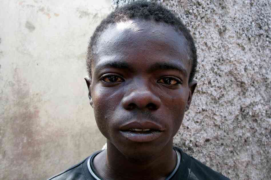 Edison Charles, 19, contracted cholera early in 2011 and spent six days in a clinic. He says the disease is all over the Port-au-Prince slum of Cite Soleil: "The cholera is like death; it's going from door to door." 