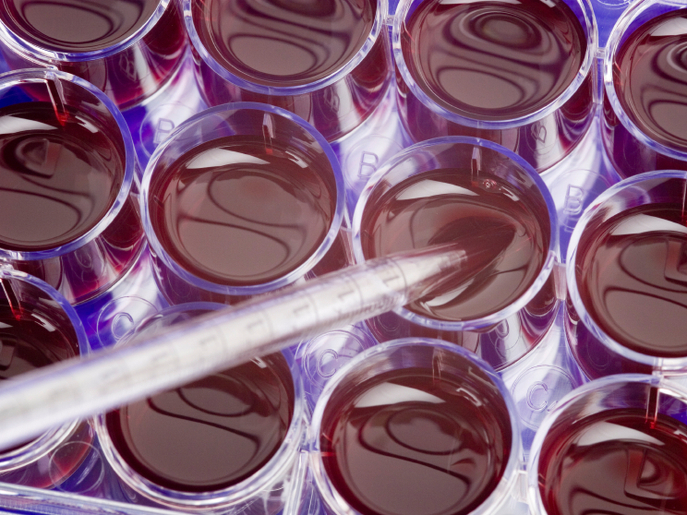 There's a funding tempest in a cell culture.