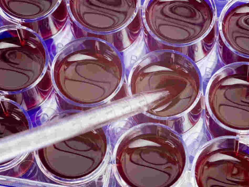 There's a funding tempest in a cell culture.