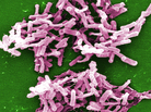 When it comes to taking up residence in your intestines, Clostridium difficile, like these, may get some help from common heartburn drugs. When it comes to taking up residence in your intestines, Clostridium difficile, like these, may get some help from common heartburn drugs.