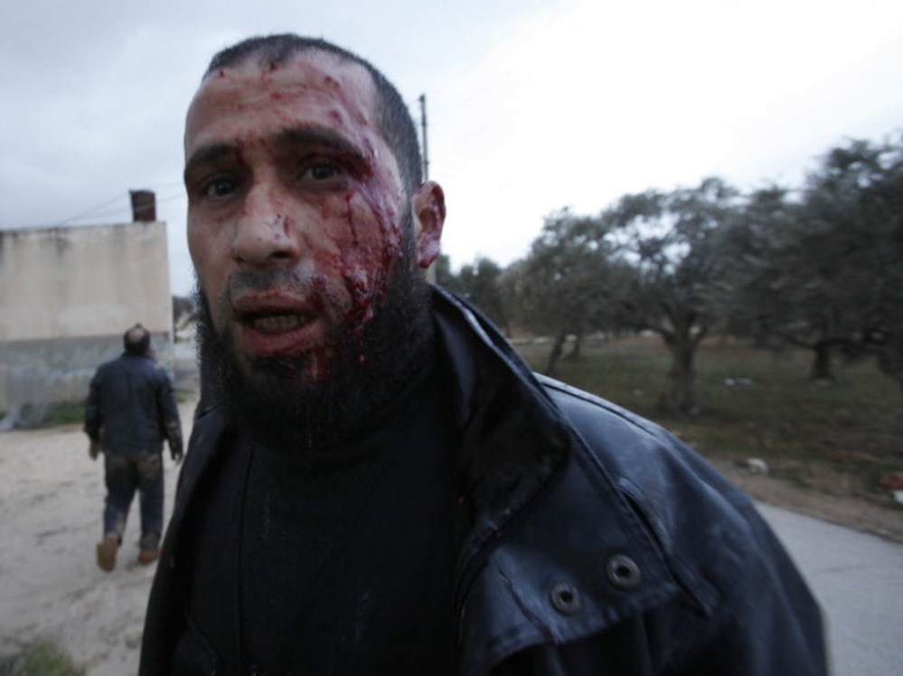 This anti-regime fighter retreated for medical treatment following an exchange of fire with army troops Wednesday in Idlib, Syria.