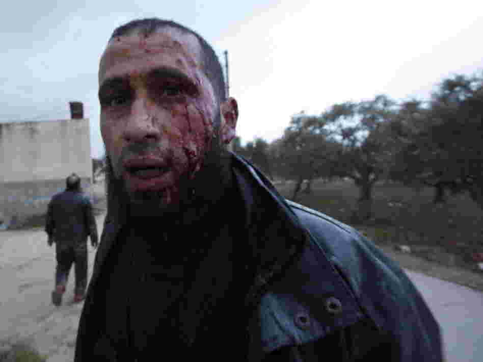 This anti-regime fighter retreated for medical treatment following an exchange of fire with army troops Wednesday in Idlib, Syria.