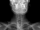 Everything looked fine on my CT scan, but I didn't sound even close to right. Everything looked fine on my CT scan, but I didn't sound even close to right.