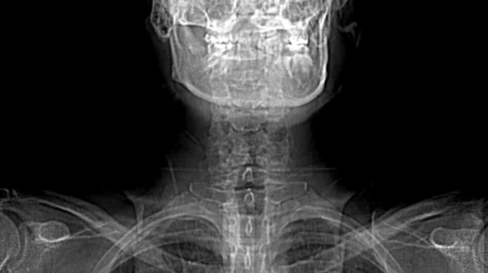Everything looked fine on my CT scan, but I didn't sound even close to right.