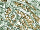 H5N1 avian flu viruses (seen in gold) grow inside canine kidney cells (seen in green). H5N1 avian flu viruses (seen in gold) grow inside canine kidney cells (seen in green).