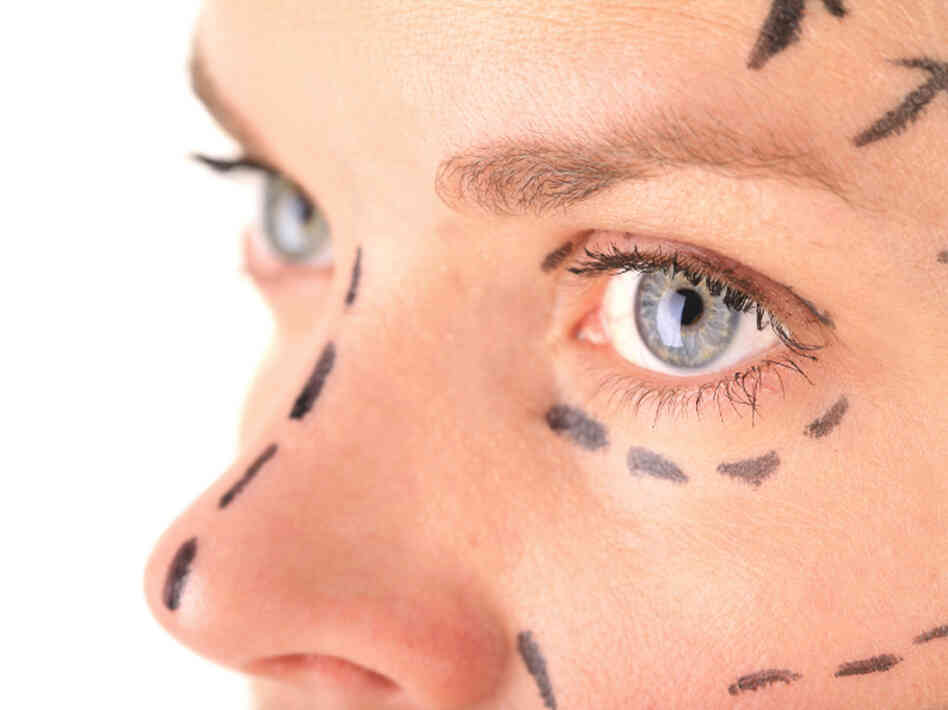 Plastic surgeons say they're getting busier lately.