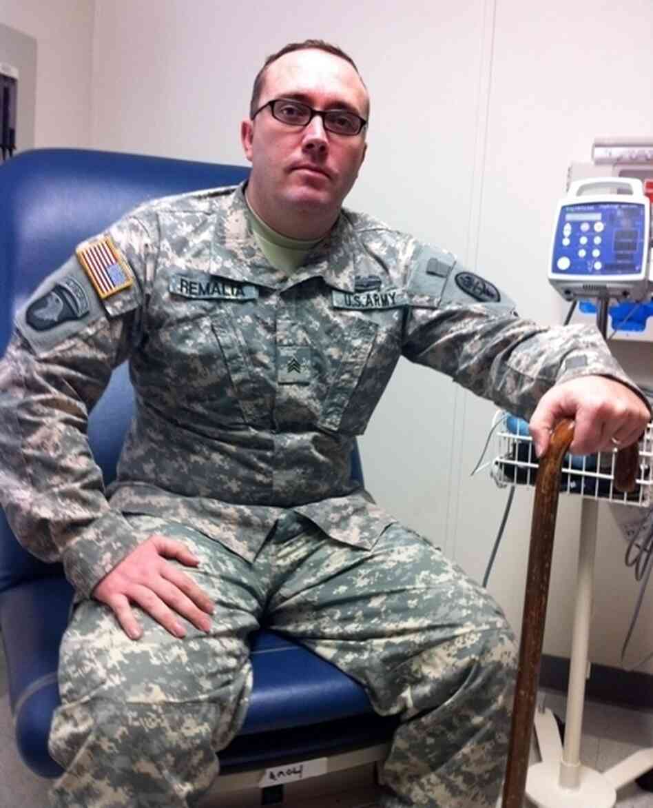 Sgt. Rick Remalia is familiar with pain. He broke his back, hip and pelvis in Afghanistan. Remalia says acupuncture is the first treatment that has really made a difference. Sgt. Rick Remalia is familiar with pain. He broke his back, hip and pelvis in Afghanistan. Remalia says acupuncture is the first treatment that has really made a difference.