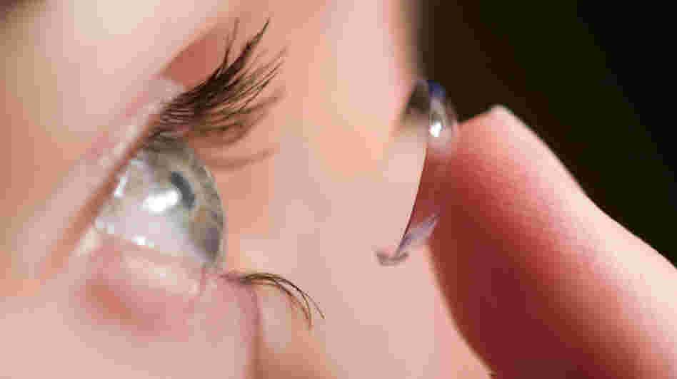 Contact lens Contact lens