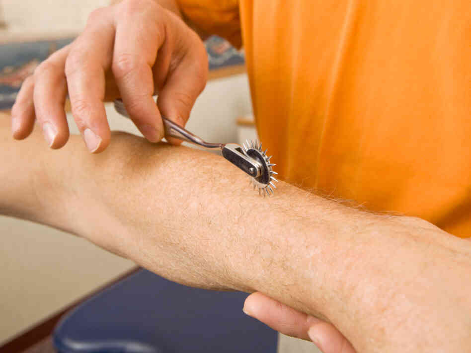 Pinwheels like these are often used to test nerve responses. Pinwheels like these are often used to test nerve responses.
