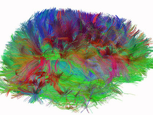 A diffusion spectrum image shows the brain wiring in a healthy human adult. A diffusion spectrum image shows the brain wiring in a healthy human adult.
