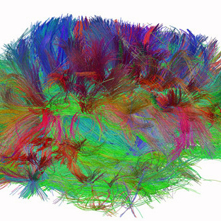 A diffusion spectrum image shows the brain wiring in a healthy human adult. 