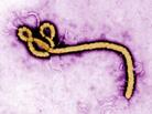 The Ebola virus causes a hemorrhagic fever that can be deadly. The Ebola virus causes a hemorrhagic fever that can be deadly.