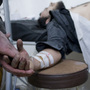 A wounded Syrian undergoes treatment at a makeshift hospital in a house in the Baba Amr district of the central city of Homs. 