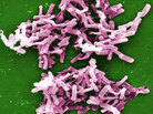 The C. difficile bacteria causes infections that kill about 14,000 Americans each year, the CDC reports. The C. difficile bacteria causes infections that kill about 14,000 Americans each year, the CDC reports.