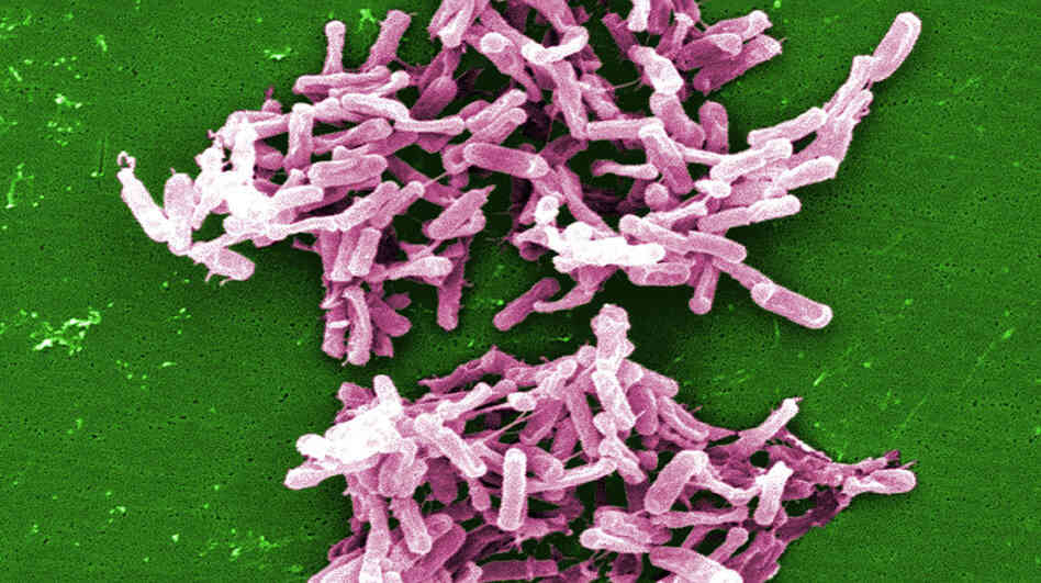 The C. difficile bacteria causes infections that kill about 14,000 Americans each year, the CDC reports. The C. difficile bacteria causes infections that kill about 14,000 Americans each year, the CDC reports.
