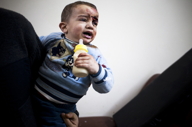A baby wounded by shrapnel is shown at the main clinic in the Baba Amr district of Homs, Syria. "It's very scary. The hospital is not very protected. Most of the windows are broken from the blasts," Daniels says. "The doctors kept working. They look like they don't even hear the noise of the bombing. They are very brave people."