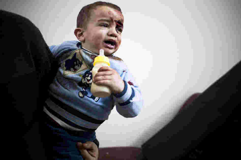 A baby wounded by shrapnel is shown at the main clinic in the Baba Amr district of Homs, Syria. "It's very scary. The hospital is not very protected. Most of the windows are broken from the blasts," Daniels says. "The doctors kept working. They look like they don't even hear the noise of the bombing. They are very brave people."