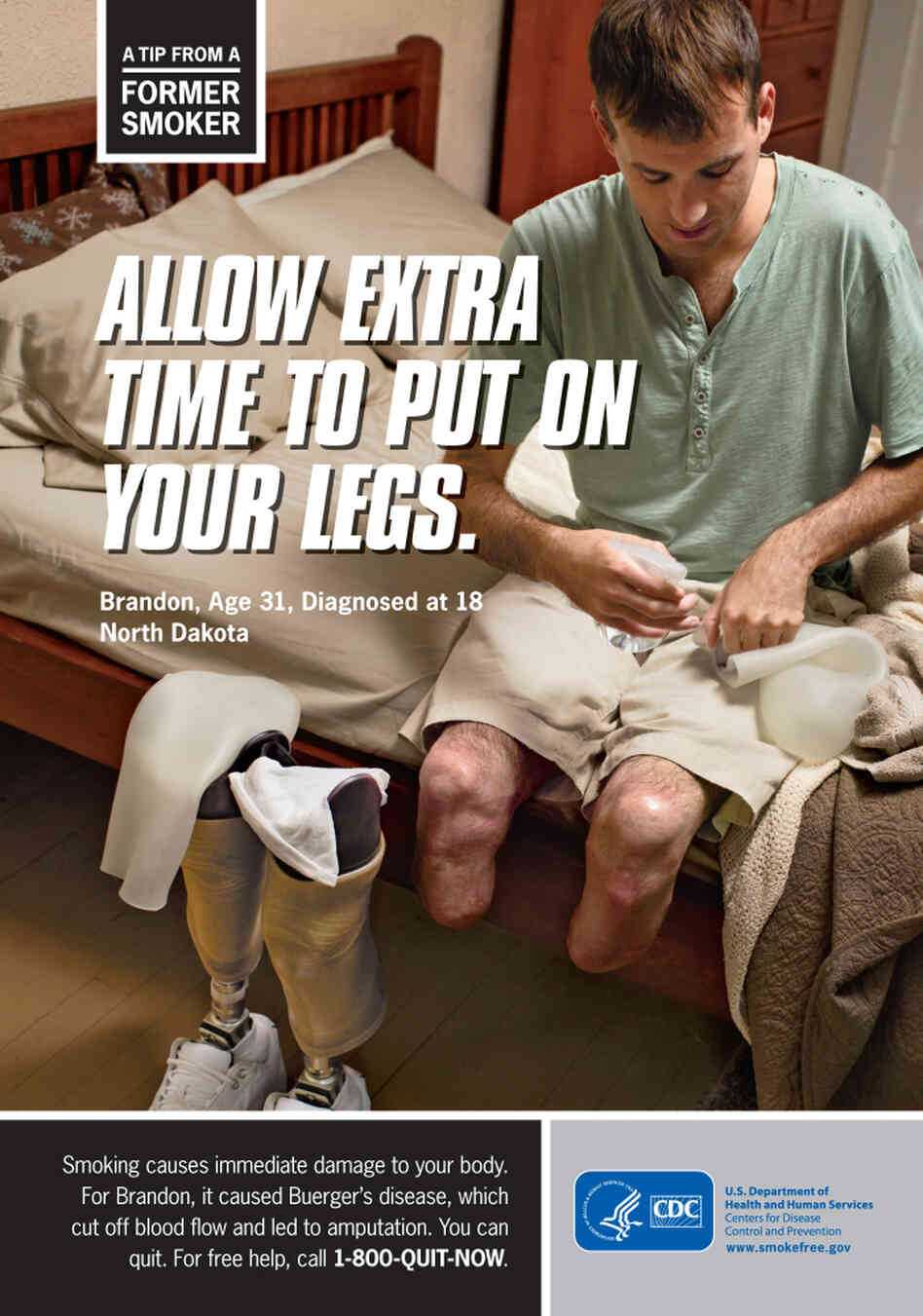 One of the graphic anti-smoking ads that the Centers for Disease Control and Prevention will run soon.