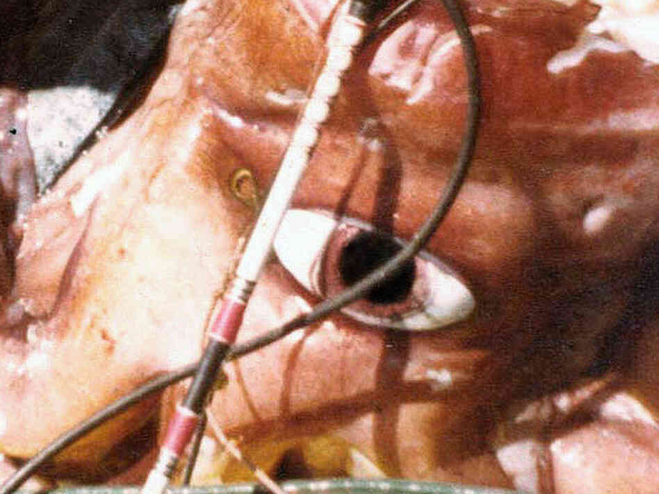 This giant squid was caught about 10 miles off the shores of Oahu, Hawaii, in 1981. The pupil of its eye measured more than 3.5 inches across. 