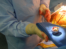 Young-min Kwon of Massachusetts General Hospital holds the metal-alloy ball of Susy Mansfield's faulty artificial hip joint. The yellowish tissue on top is dead muscle caused by a reaction to the metal debris produced by the defective hip implant. Young-min Kwon of Massachusetts General Hospital holds the metal-alloy ball of Susy Mansfield's faulty artificial hip joint. The yellowish tissue on top is dead muscle caused by a reaction to the metal debris produced by the defective hip implant.