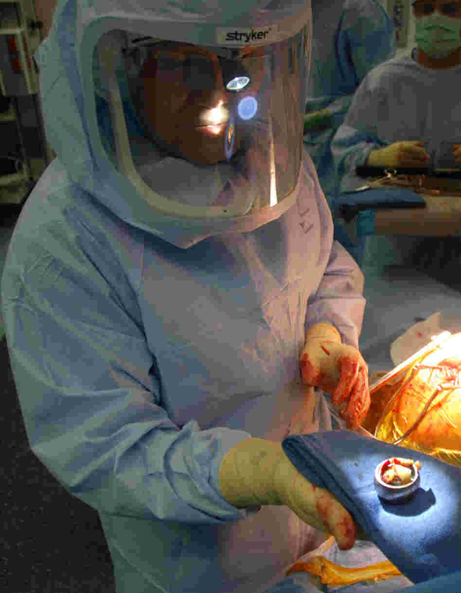 Young-min Kwon of Massachusetts General Hospital holds the metal-alloy ball of Susy Mansfield's faulty artificial hip joint. The yellowish tissue on top is dead muscle caused by a reaction to the metal debris produced by the defective hip implant.