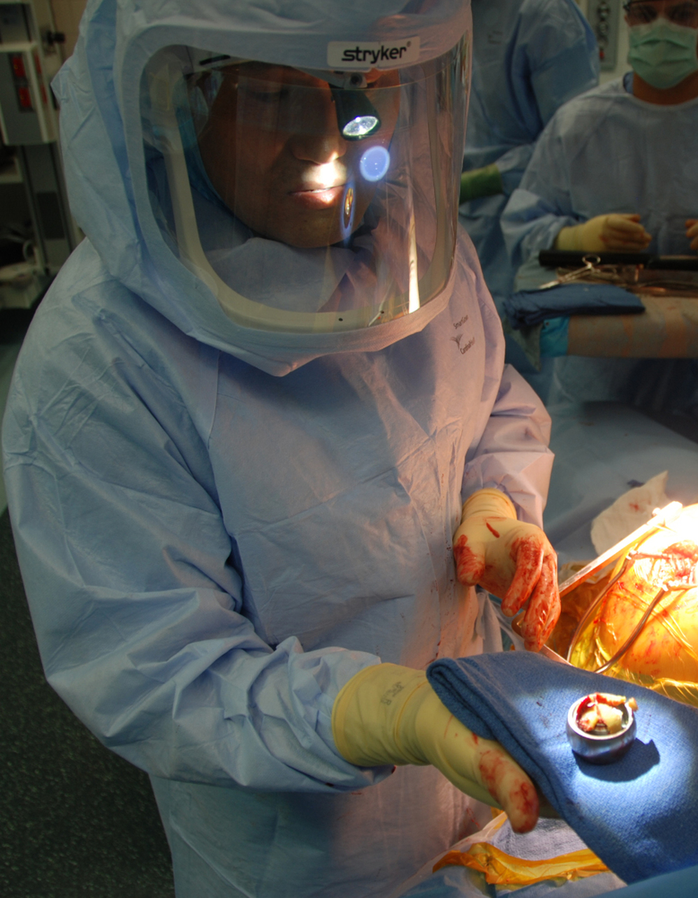 Young-min Kwon of Massachusetts General Hospital holds the metal-alloy ball of Susy Mansfield's faulty artificial hip joint. The yellowish tissue on top is dead muscle caused by a reaction to the metal debris produced by the defective hip implant.