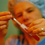 A technician places a fertilized human egg in a test tube. New technology has led to new legal questions: What happens to survivors benefits when a baby is conceived after a father's death? A technician places a fertilized human egg in a test tube. New technology has led to new legal questions: What happens to survivors benefits when a baby is conceived after a father's death?