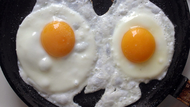 If Variations 1-5 are your brain, Variations 25-29 are your brain on drugs. (iStockphoto.com)