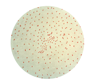 The red dots are Bordatella pertussis bacteria, the cause of whooping cough.