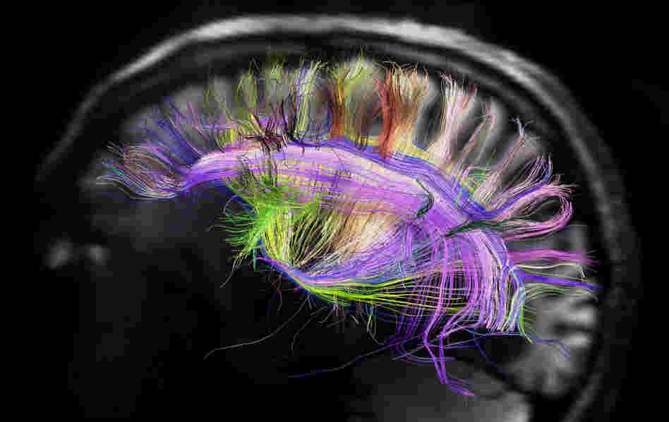 This image shows the grid structure of the major pathways of the brain. It was created using a scanner that's part of the Human Connectome Project, a five-year effort which is studying and mapping the human brain. This image shows the grid structure of the major pathways of the brain. It was created using a scanner that's part of the Human Connectome Project, a five-year effort which is studying and mapping the human brain.