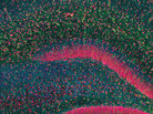 This image is a section of the hippocampus, stained with colors using various lab techniques. This image is a section of the hippocampus, stained with colors using various lab techniques.