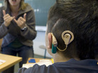 A schoolboy with a cochlear implant listens to his teacher during lessons at a school for the hearing impaired in Germany. The implants have dramatically changed the way deaf children learn and transition out of schools for the deaf and into classrooms with non-disabled students. A schoolboy with a cochlear implant listens to his teacher during lessons at a school for the hearing impaired in Germany. The implants have dramatically changed the way deaf children learn and transition out of schools for the deaf and into classrooms with non-disabled students.