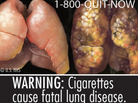 This image provided by the U.S. Food and Drug Administration shows one of nine new warning labels it wants cigarette makers to use. Tobacco companies have sued, claiming the mandate is unconstitutional. This image provided by the U.S. Food and Drug Administration shows one of nine new warning labels it wants cigarette makers to use. Tobacco companies have sued, claiming the mandate is unconstitutional.